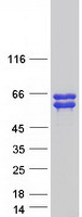 Coomassie blue staining of purified ANKRD34A protein