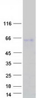 protq6beb4 sp5 human recombinant protein