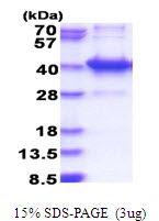 3ug by SDS-PAGE under reducing condition and visualized by coomassie blue stain.