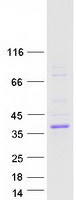 protq6ich7 asphd2 human recombinant protein