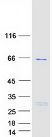protq6ipx1 tbc1d3c human recombinant protein