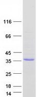 Coomassie blue staining of purified OGFOD2 protein