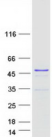 protq6nte8 c5orf45 mrnip human recombinant protein