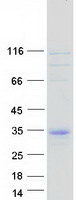 protq6nuj2 c11orf87 human recombinant protein