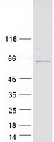 Coomassie blue staining of purified UGT3A1 protein