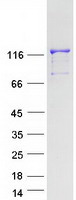 protq6nwy9 prpf40b human recombinant protein