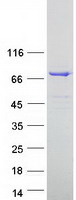 Coomassie blue staining of purified ESRP1 protein
