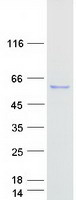 protq6nxr4 c8orf41 tti2 human recombinant protein