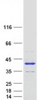 Coomassie blue staining of purified ANKRD54 protein