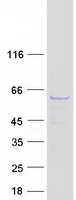 Coomassie blue staining of purified CDC73 protein