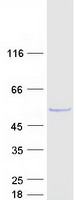 Coomassie blue staining of purified DUS1L protein