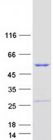 protq6p3s1 c1orf218 human recombinant protein