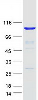 protq6p3x3 ttc27 human recombinant protein