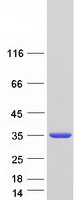 protq6p587 fahd1 human recombinant protein