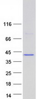 Coomassie blue staining of purified ANKRD16 protein