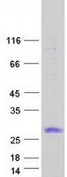 protq6pey1 tmem88 human recombinant protein