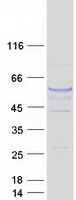 protq6pey2 tuba3e human recombinant protein