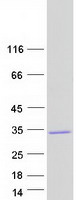 Coomassie blue staining of purified DCUN1D2 protein