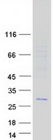 Coomassie blue staining of purified C11orf88 protein