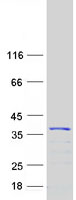 protq6pil6 kcnip4 human recombinant protein