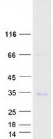 protq6piz9 trim trat1 human recombinant protein