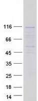 protq6pji9 wdr59 human recombinant protein