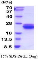 3ug by SDS-PAGE under reducing condition and visualized by coomassie blue stain