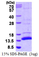 3ug by SDS-PAGE under reducing condition and visualized by coomassie blue stain.