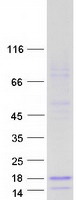 protq6udr6 spint4 human recombinant protein