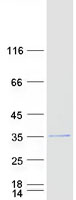protq6ue05 wbs28 wbscr28 human recombinant protein