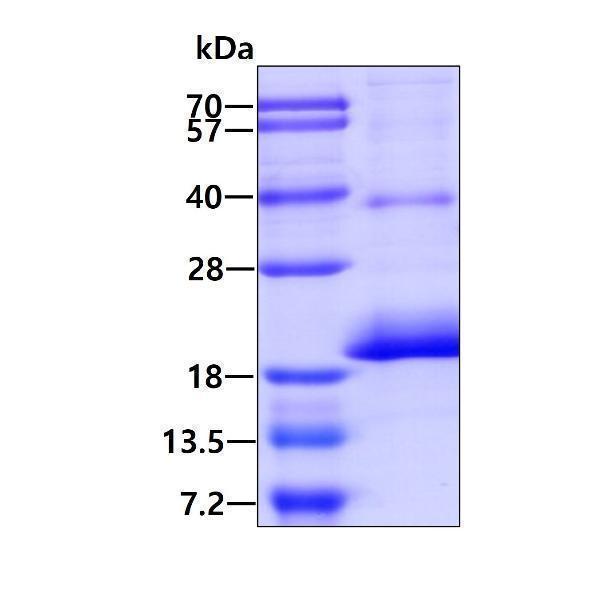protq6uwj8 sdspage human cd164l2 recombinant protein_1