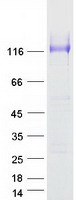 Coomassie blue staining of purified SUSD1 protein