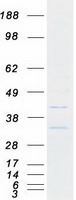 Coomassie blue staining of purified B3GNT9 protein