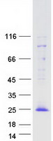 Coomassie blue staining of purified TOMM20L protein