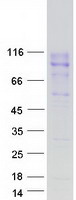 Coomassie blue staining of purified CEACAM20 protein