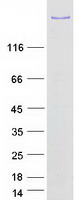 Coomassie blue staining of purified BCOR protein