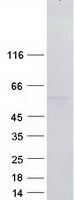 protq6xe24 rbms3 human recombinant protein