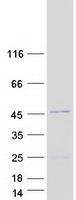 Coomassie blue staining of purified KYAT3 protein