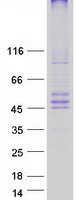 Coomassie blue staining of purified CERS6 protein