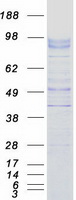 protq6zn44 unc5a human recombinant protein