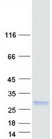 Coomassie blue staining of purified TMEM91 protein