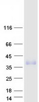 protq6zp80 tmem182 human recombinant protein