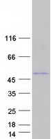 Coomassie blue staining of purified TMPPE protein