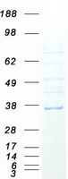 Coomassie blue staining of purified FAM92B protein