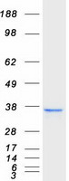 protq6zvk8 nudt18 human recombinant protein