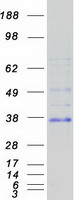 Coomassie blue staining of purified RHEX protein