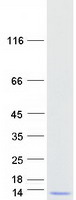 Coomassie blue staining of purified GTF2H5 protein