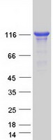 Coomassie blue staining of purified UNC13D protein