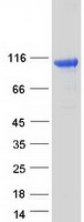 Coomassie blue staining of purified MTSS2 protein