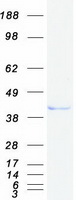 Coomassie blue staining of purified KCTD9 protein